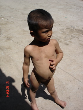 �ܵ����챦�����ص�Ӫ�����������Ρ�